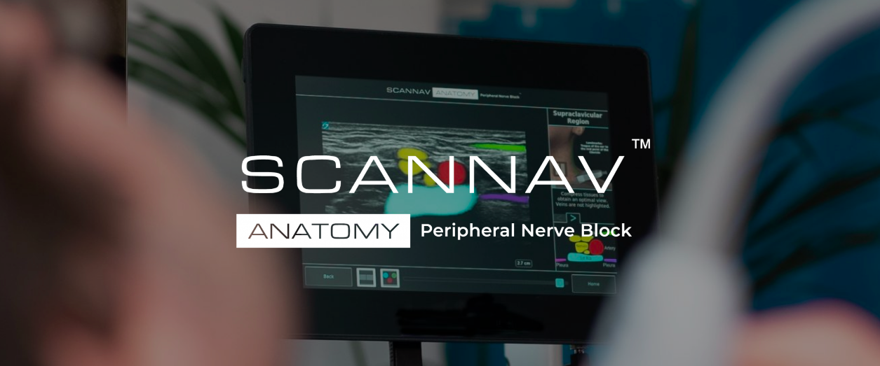 ScanNav Blocchi Nervi Periferici