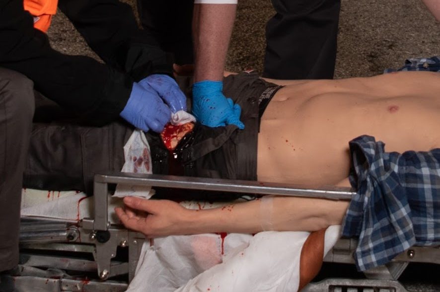 trauma 2 packing