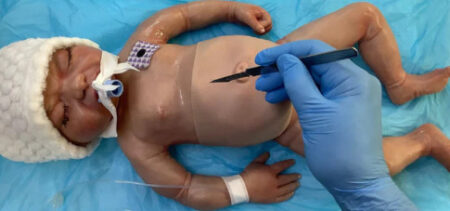 Chirurgia Pediatrica