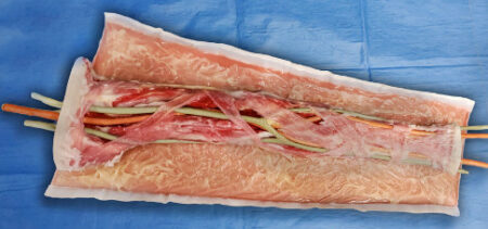 Chirurgia Vascolare