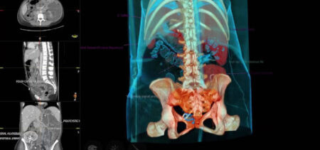 Radiologia