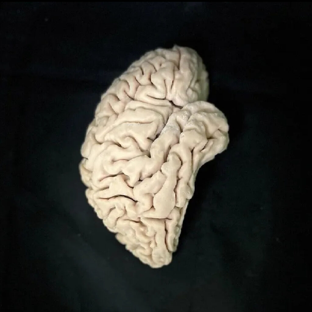 Cervello