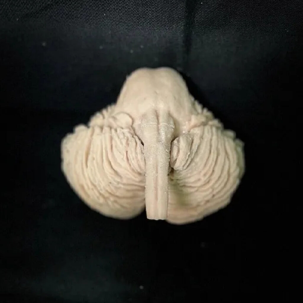 Cervello