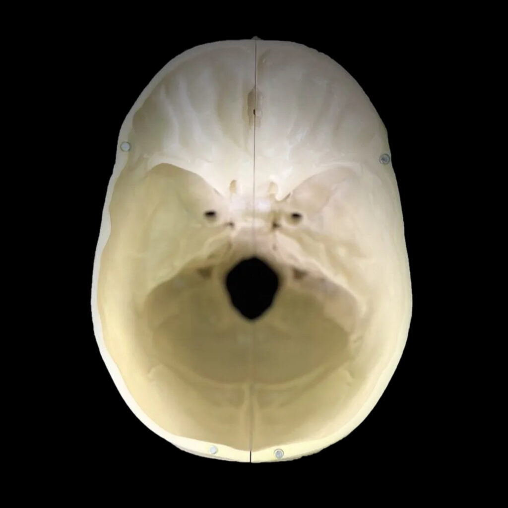 Cranio Anatomico