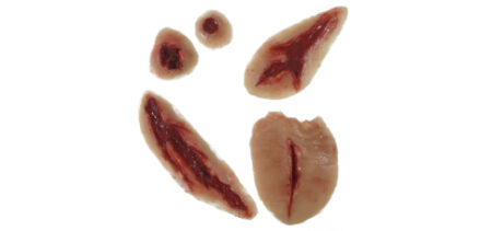 MP002 Set Ferite Trauma Thumbnail