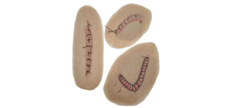 MP0212 Set Ferite Suture Post Chirurgia Thumbnail