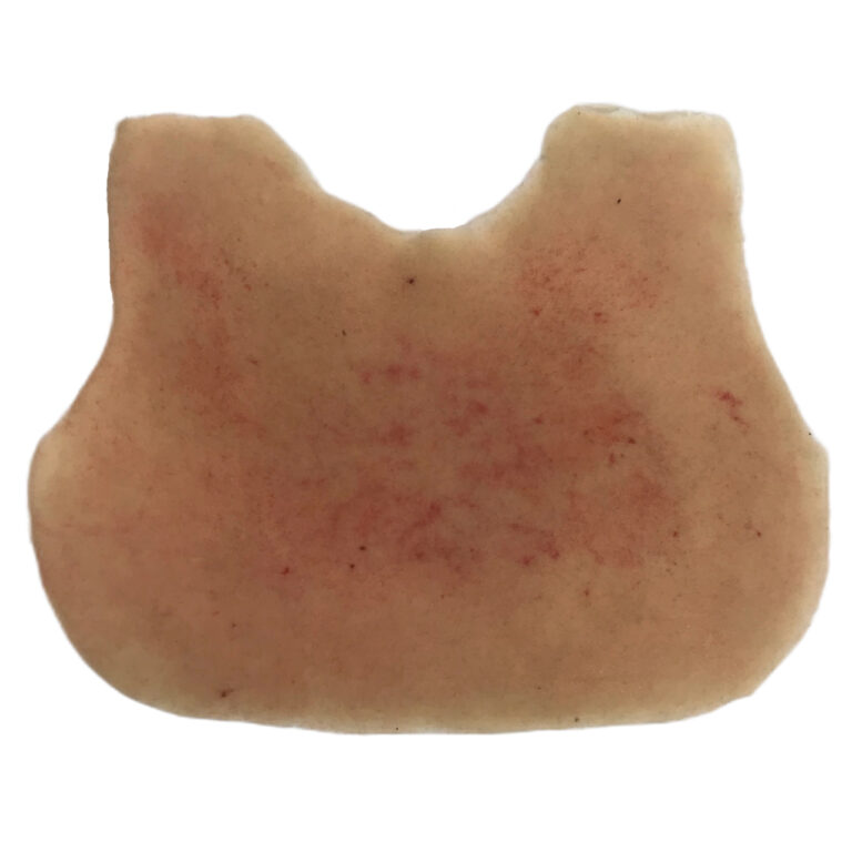 MP314 Pad Rash Meningite
