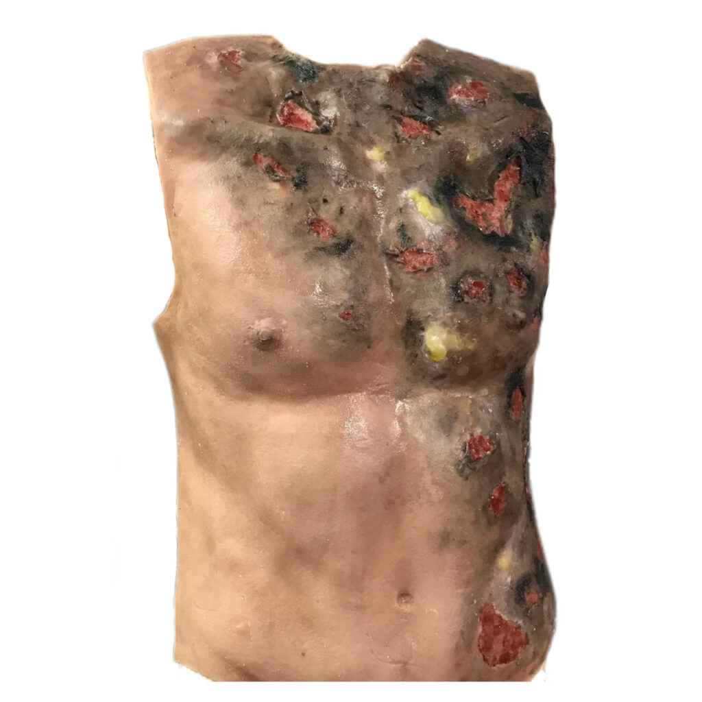 MS310 Pad Ferita Ustione Torso