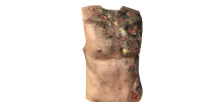 MS310 Pad Ferita Ustione Torso Thumbnail