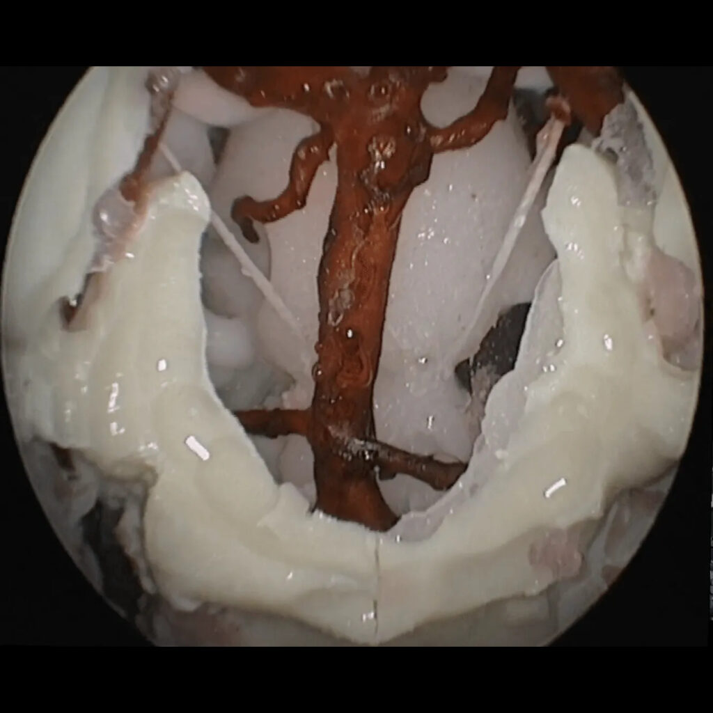 Simulatore Endonasale Endoscopico