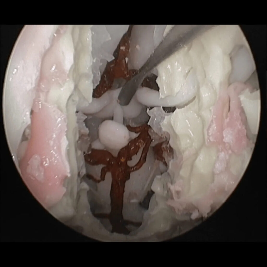 Simulatore Endonasale Endoscopico