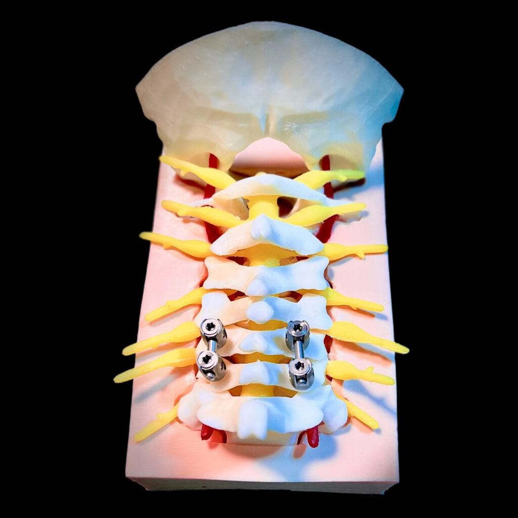 Simulatore Giunzione Craniocervicale