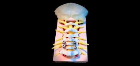 Simulatore Giunzione Craniocervicale