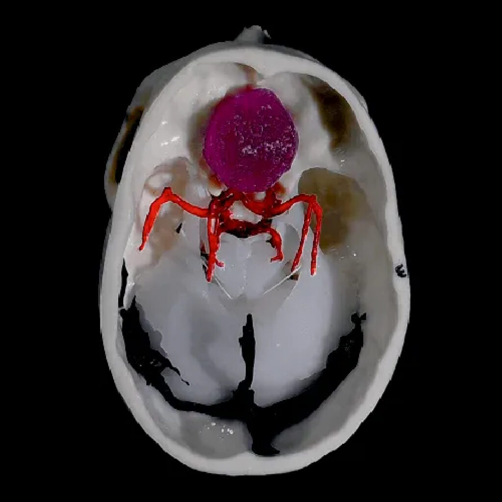 Simulatore Transcranico