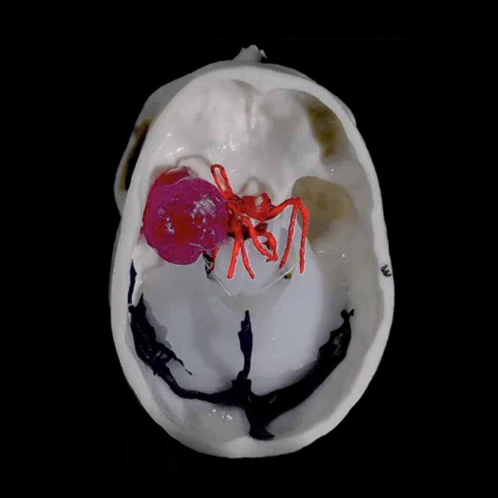 Simulatore Transcranico