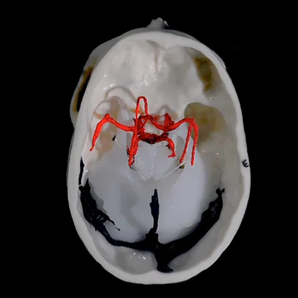 Simulatore Transcranico