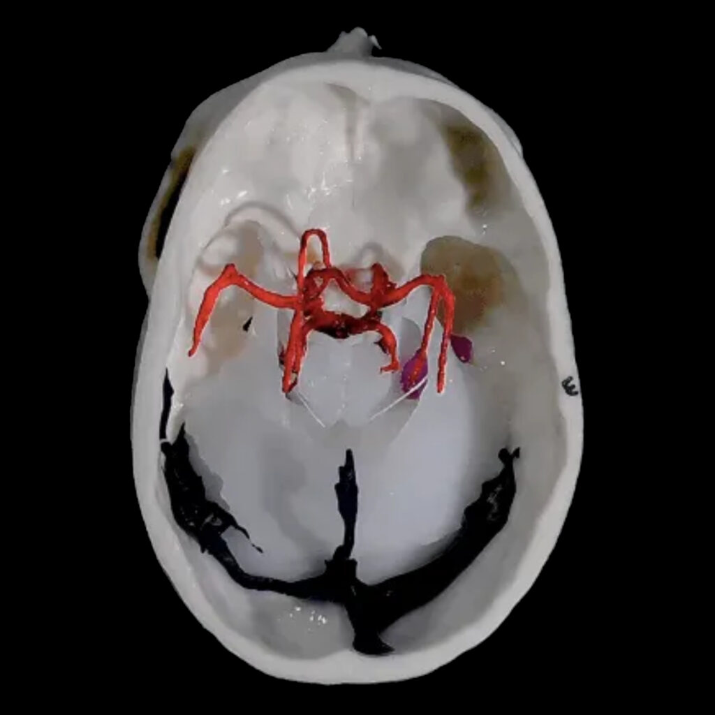 Simulatore Transcranico