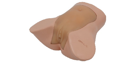 Perforazione e ablazione del tumore uterino