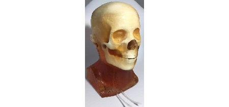 Testa Adulta Ematoma per CT/US/MRI