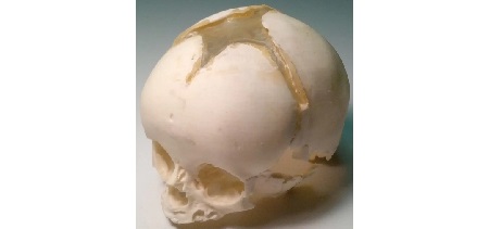 Cranio Neonatale CT/US/MRI