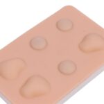 cisti e ascessi-2