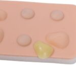 cisti e ascessi-6