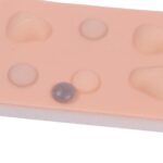 cisti e ascessi-9