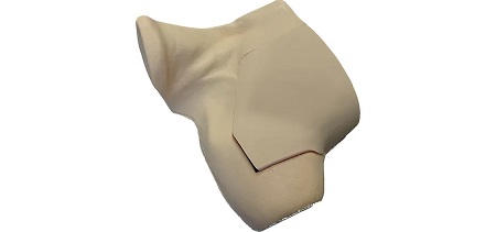 Blocco infraclavicolare