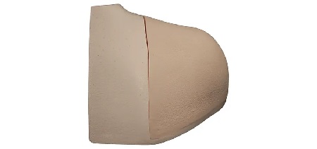 Blocco soprascapolare
