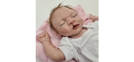 Baby Nina - Labiopalatoschisi