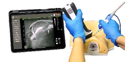 Biopsia e ablazione dei noduli tiroidei