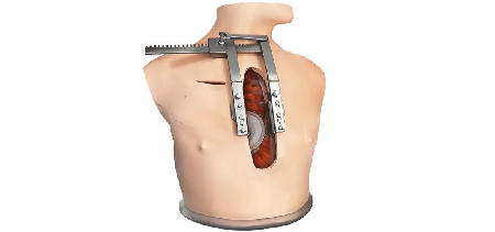 Chirurgia toracica